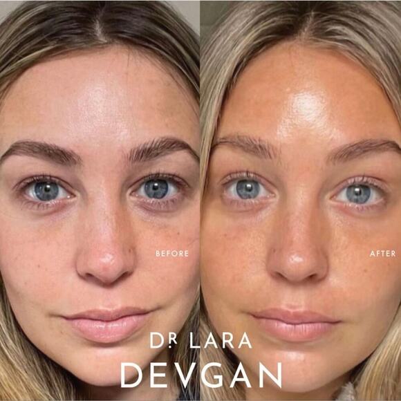 Dr Lara Devgan Peptide Eye Cream - Picture 3 of 7